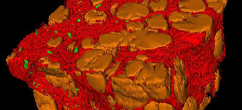 Image: Studying tissue samples in “virtual” 3D -- Please see Related Links below for additional images (Photo courtesy of the University of Leeds).